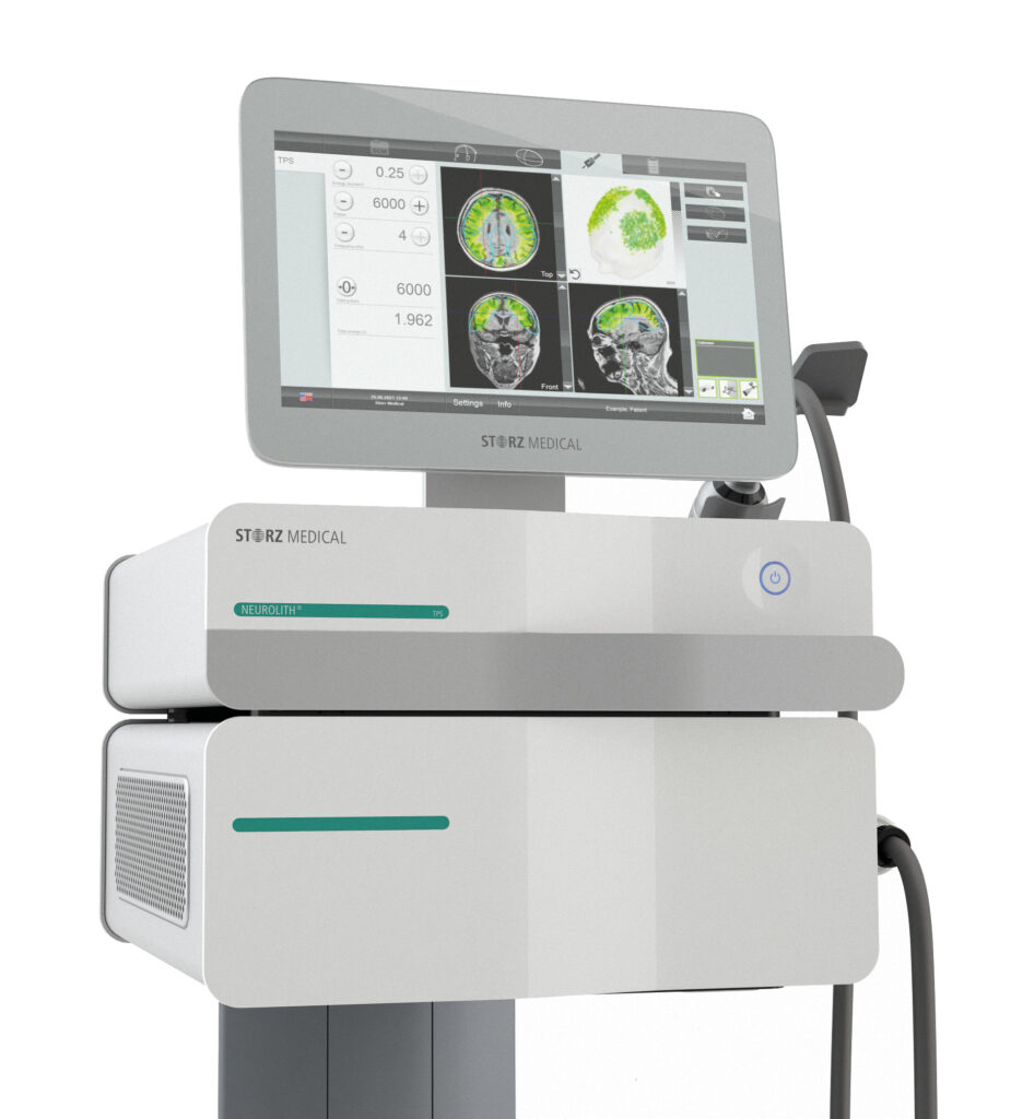 Alzheimerjeva bolezen___